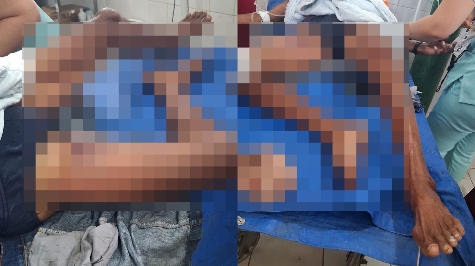 Idoso é agredido e roubado após assalto em comunidade de Óbidos
